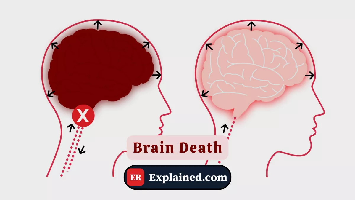 Brain Death: Definition and Clinical Context