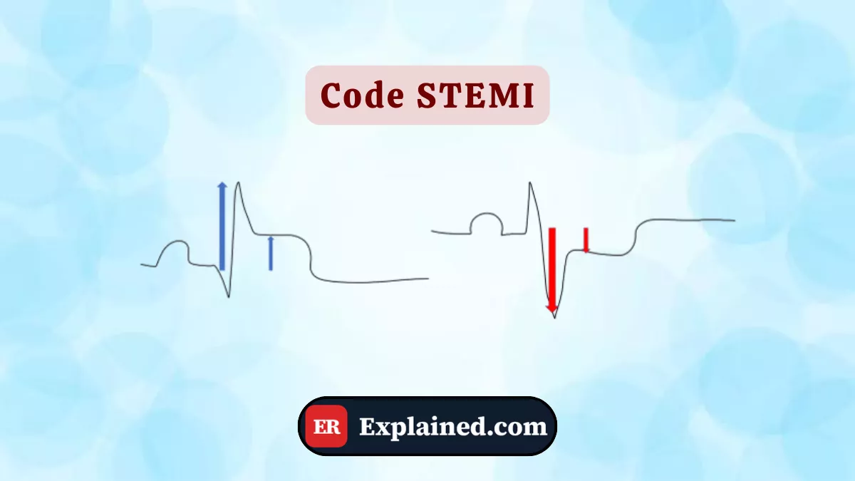 Code STEMI: The 51-Minute Race to Save a Heart