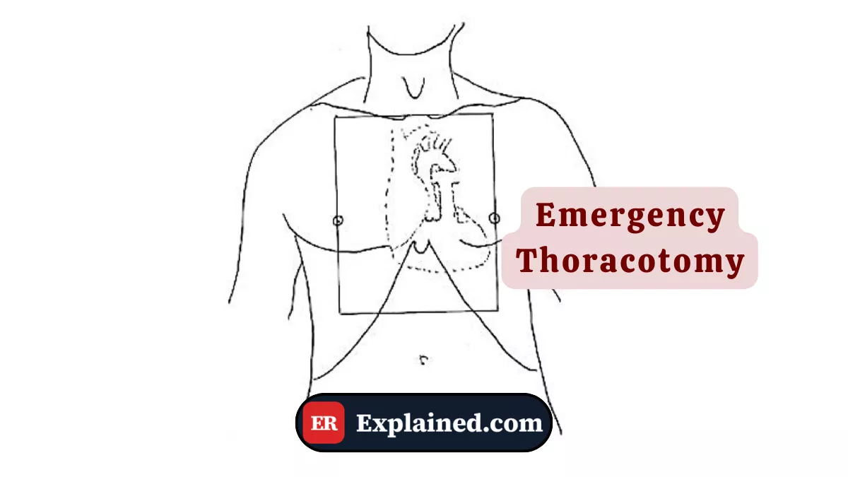 Emergency Thoracotomy: When the Chest Is Opened in the ER Itself