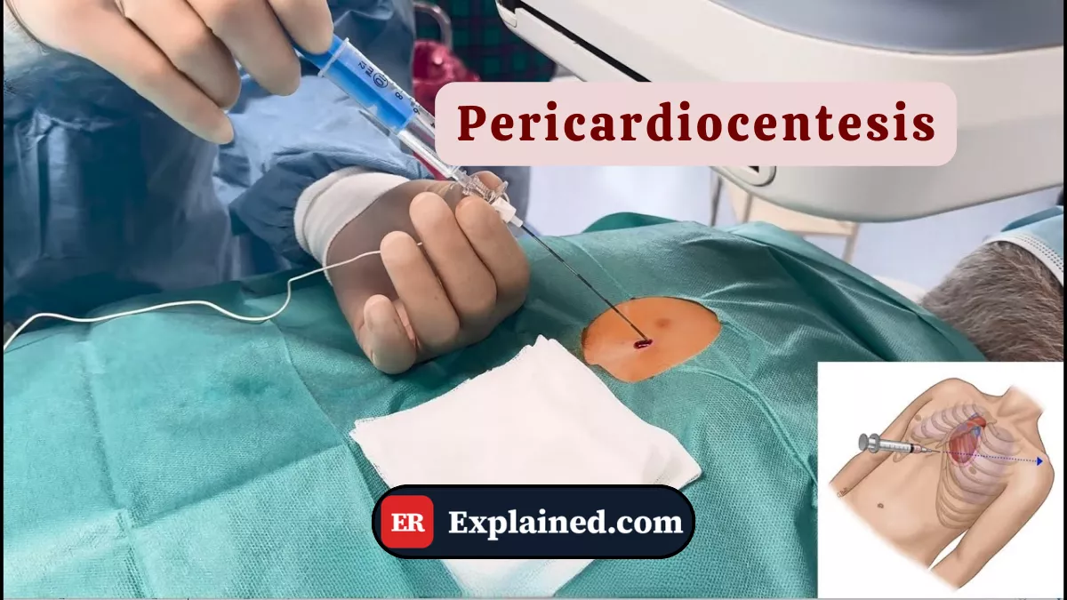 Pericardiocentesis: How to Drain It When the Heart Is Being Compressed