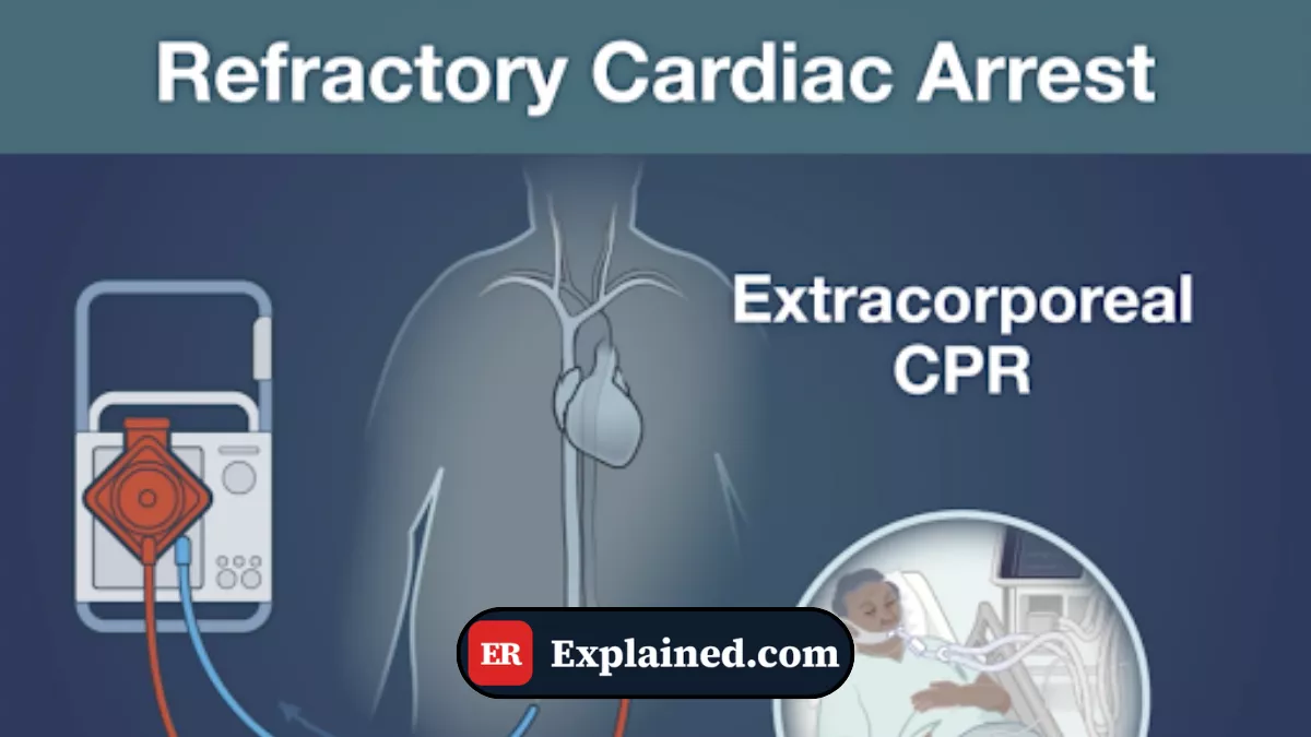 Refractory Cardiac Arrest: When the Heart Refuses to Beat