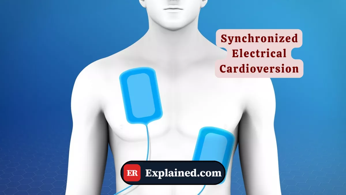 Synchronized Electrical Cardioversion: How the Shock Reverses Arrhythmias in the ER